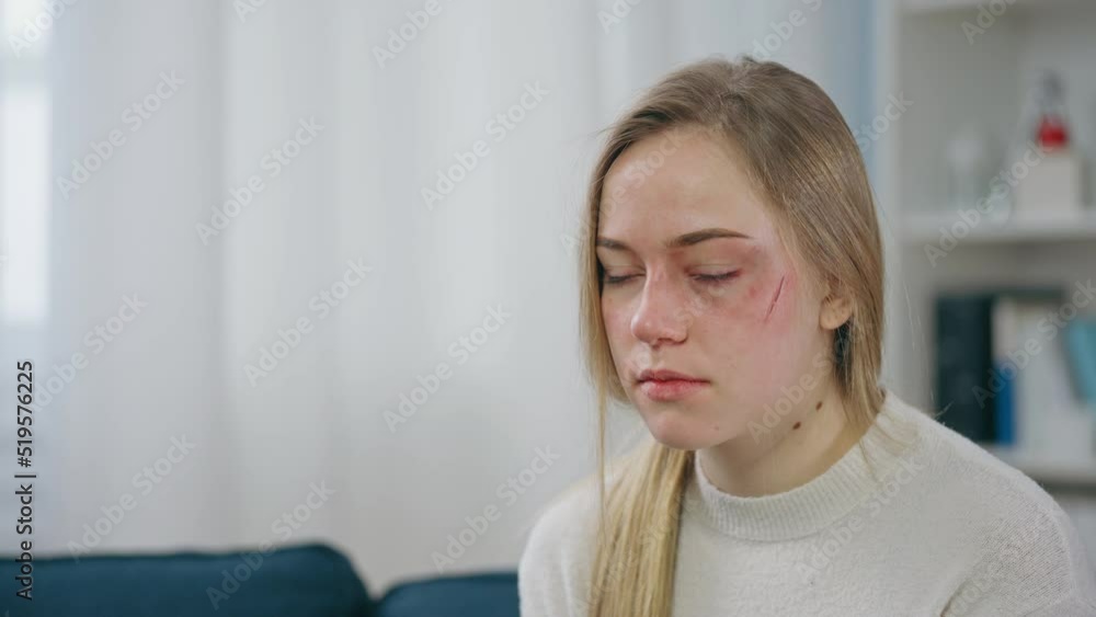 Shocked injured young woman talking to police after accident, investigation Shocked injured young woman talking to police after accident, investigation