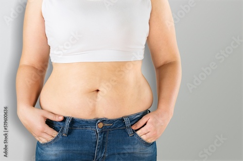 Obese woman against light background. Weight loss surgery