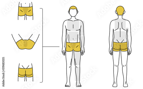メンズ脱毛、全身（前と後ろ）とVIOの部位案内、下着着用 photo