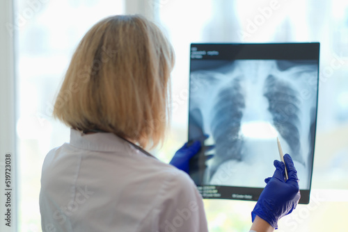 Doctor pulmonologist examining x-ray photograph of lungs photo