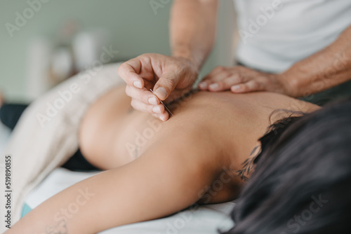 therapist about to stick an acupuncture needle photo
