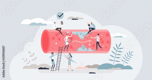 High cholesterol checkup to detect disease or blood risks tiny person concept. Heart attack awareness from too high pressure and unhealthy artery vector illustration. Cardiologist patient health care