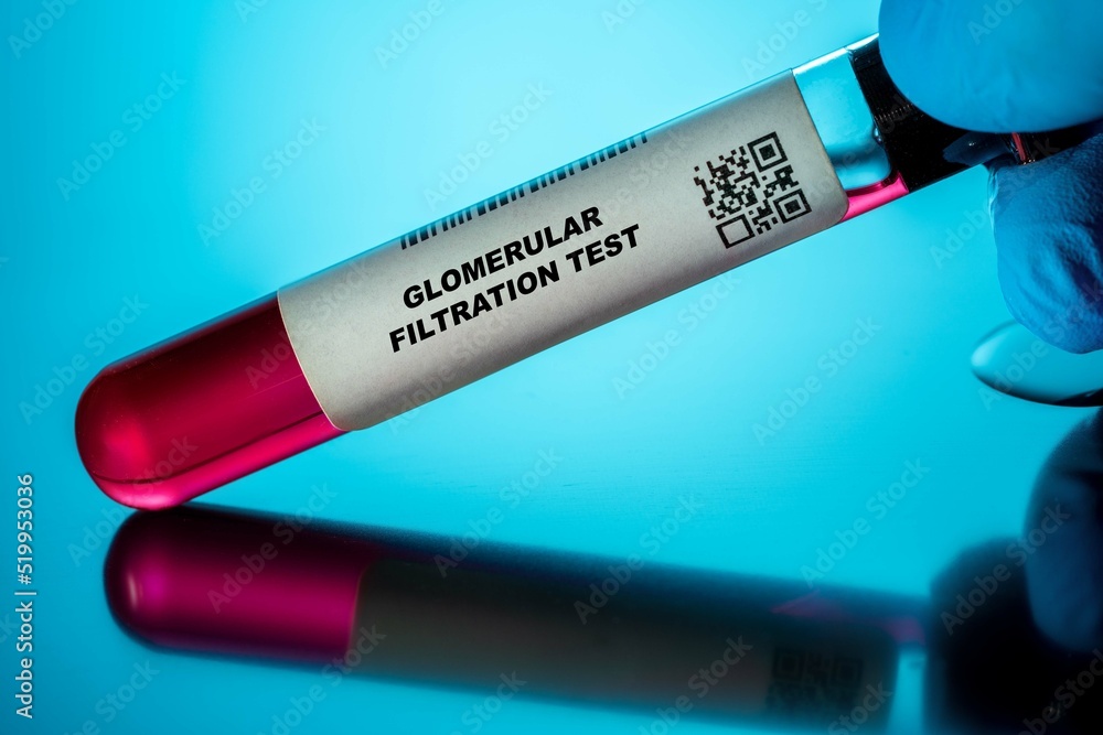 Glomerular Filtration Test Blood Tests For Older Adults Recommended glomerular-filtration-test-blood-tests-for-older-adults-recommended