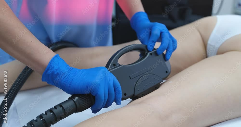 Dermatologist with laser black device on female legs Dermatologist with laser black device on female legs