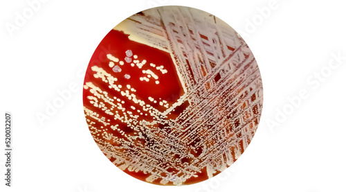 Fototapeta Naklejka Na Ścianę i Meble -  Staphylococcus aureus: Gram-positive, to Gram-variable, nonmotile, Coccus, beta hemolysis, saprotrophic bacterium that belongs to the family Staphylococcus growth on blood agar.