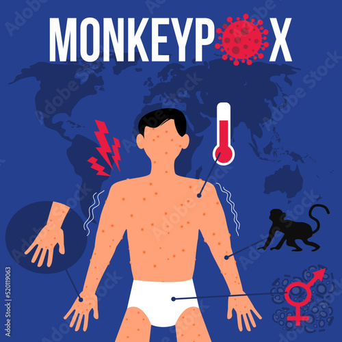 monkeypox virus symptom illustration suitable for poster and infographic