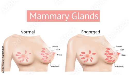 Mammary gland, Non-Lactating and Engorged breast, Female breast Anatomy, illustration Vector.