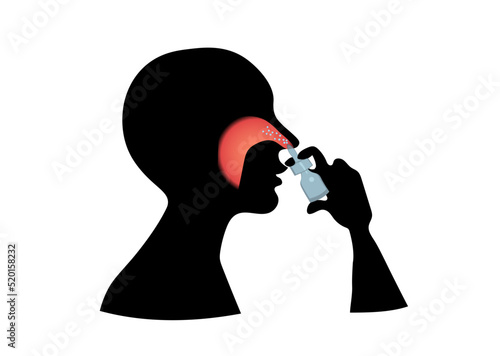 Nasal spray, profile of a man, running nose