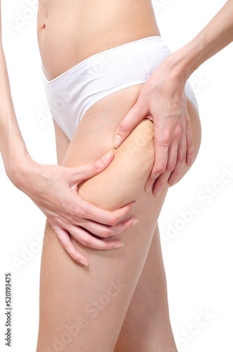 Cellulite skin on woman buttocks