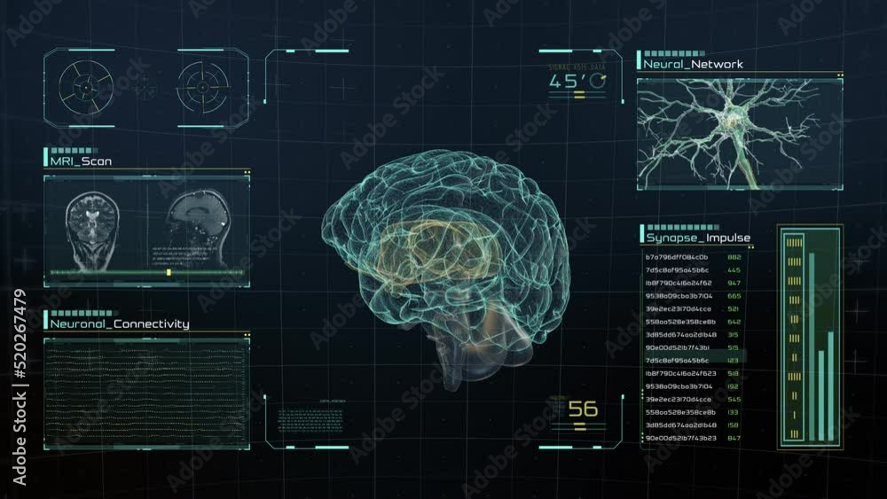 Analysis of Human Brain Anatomy Scan on Futuristic Touch Screen