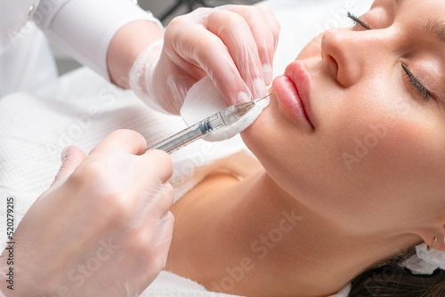 Lip augmentation and correction procedure in a cosmetology salon. The specialist makes an injection in the patient's lips.