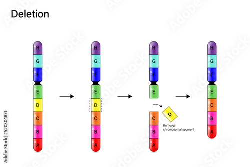 Chromosome Deletion. Genetic mutation. Alteration of chromosome structure. Vector for scientific study and biological genetics. photo