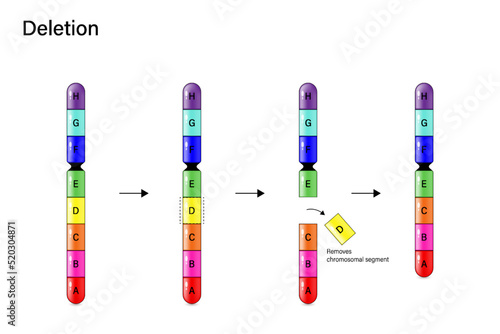 Chromosome Deletion. Genetic mutation. Alteration of chromosome structure. Vector for scientific study and biological genetics.