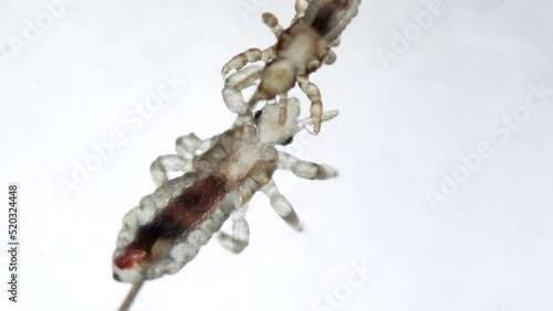Head louse on a human hair with small head lice walking around her. Extreme closeup detail of human parasite. Pediculus capitis. Human infectious disease. photo