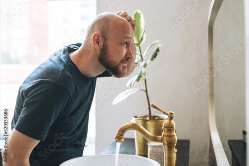 Wall Mural Young adult bearded man looking in mirror in bathroom touching head worried abou