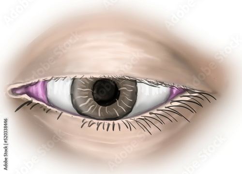 ptosis is the condition of down placing of eyelid caused by third cranial nerve palsy.