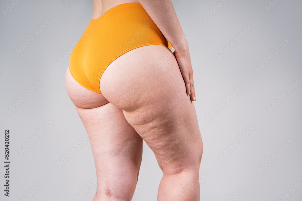 Overweight thigh, woman with fat hips and buttocks, obesity female body  with cellulite on gray background Stock Photo