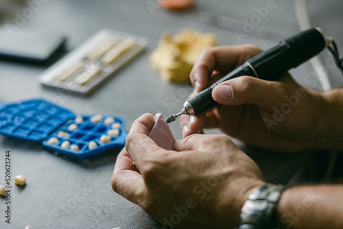 mechanical retention for adhesion of resin of dental prosthesis