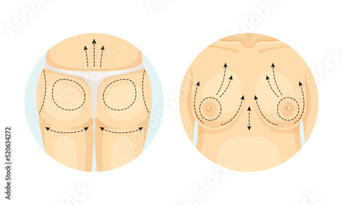 Plastic Surgery for Female Breast and Buttocks as Restoration and Reconstruction of Human Body Part in Circle Vector Set