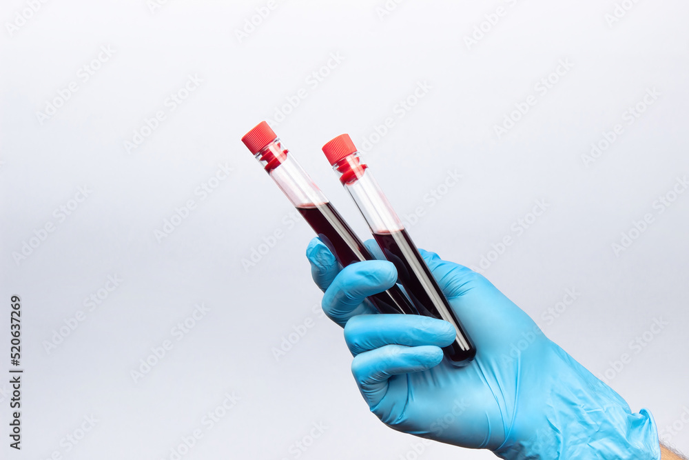 Test tubes with blood for analysis in a hand in a blue medical glove. On a white background. Lots of empty space Test tubes with blood for analysis in a hand in a blue medical glove. On a white background. Lots of empty space