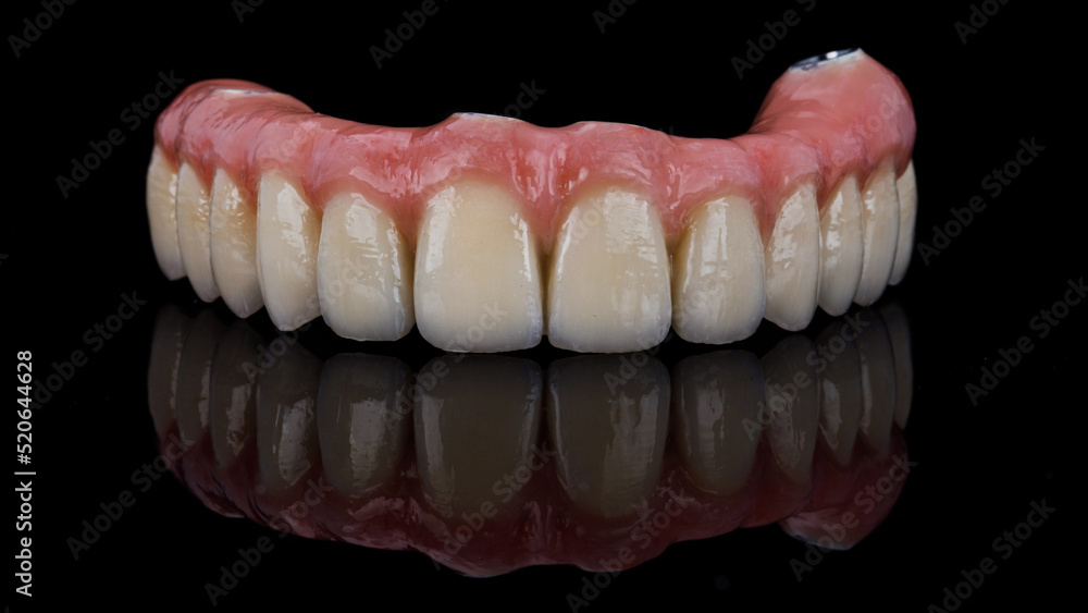Great dental prosthesis of the upper jaw made of ceramics with a pink gum on a black background with a reflection Great dental prosthesis of the upper jaw made of ceramics with a pink gum on a black background with a reflection