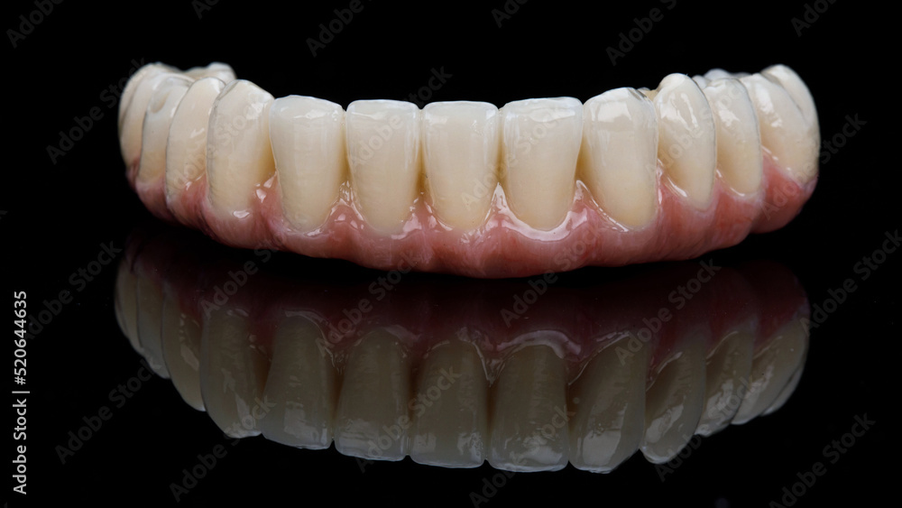 Ceramic prosthesis of the lower jaw with a pink gum on a black glass with a reflection Ceramic prosthesis of the lower jaw with a pink gum on a black glass with a reflection
