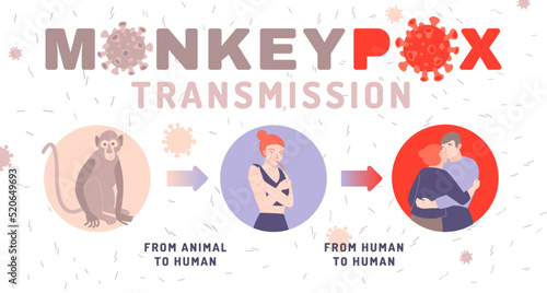Monkeypox virus infographics. Symptoms and useful information.