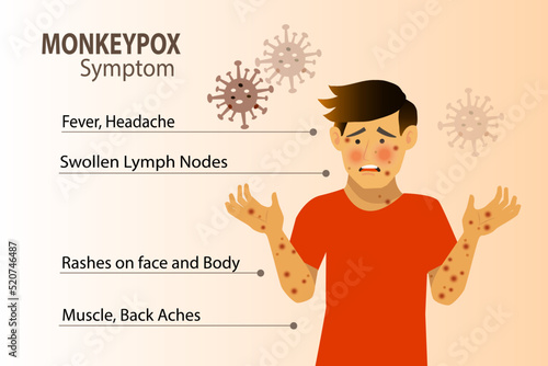 Monkeypox virus symptom infographic on patient with fever, headache, swollen lymph node, rashes on face, body and back, muscle aches. For awareness in spreading of orthopoxvirus outbreak. photo