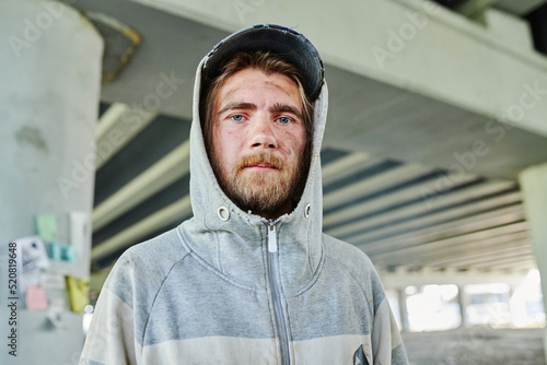Quadro su tela Portrait of homeless poor man with alcoholic bearded face looking at camera stan