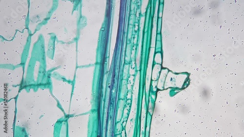 Stem of Cucurbita moschata L.S. under microscope 200x against bright field. Longitudinal section of pumpkin magnified under micrograph for science issues. Research of flora life. Nature theme photo