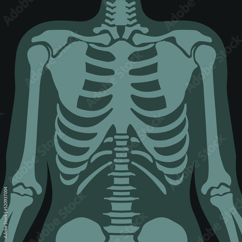 X ray of lungs and ribs, healthcare scan vector