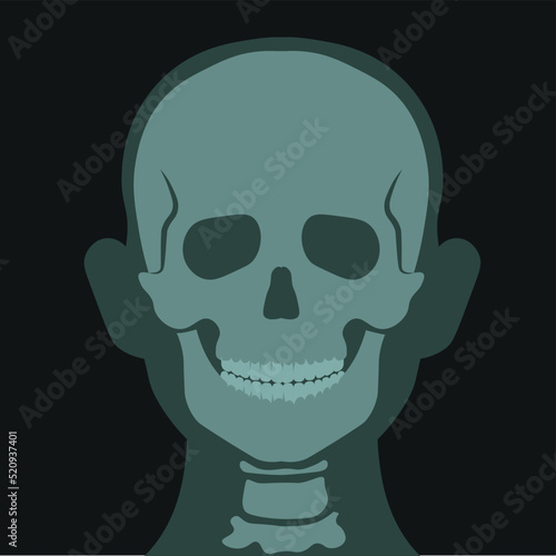 Xray of human head, skull roentgen scan vector