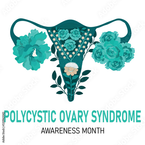 Polycystic ovary syndrome month. Vector cartoon illustration of uterus
