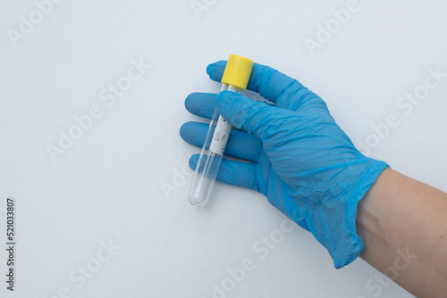 Vacuum tube for collection and blood samples with sodium citrate in blue gloves for laboratory. On white background