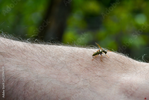 The bee sat on a man's hand