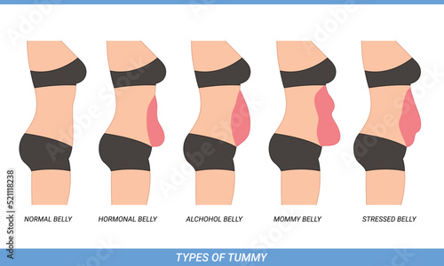 Illustration of Types Of Tummies for woman