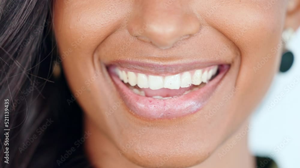 Mouth, lips and bright teeth of smiling woman with white smile and clean, perfect and clear skin. Closeup face detail of a happy laughing and cheerful female after whitening treatment at dentist Mouth, lips and bright teeth of smiling woman with white smile and clean, perfect and clear skin. Closeup face detail of a happy laughing and cheerful female after whitening treatment at dentist