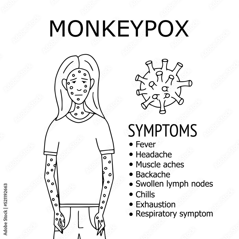 Vetor de Monkey pox infographic symptoms on human vector illustration ...