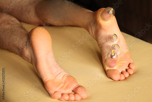 Cupping therapy. Cup vacuum massage. Cups for massage on the man's foot.