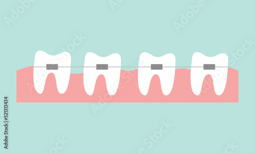 Cartoon braces teeth flat vector illustration