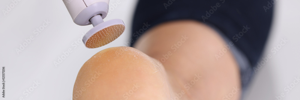 Device for cleaning dry skin on the heel, leg close-up Device for cleaning dry skin on the heel, leg close-up