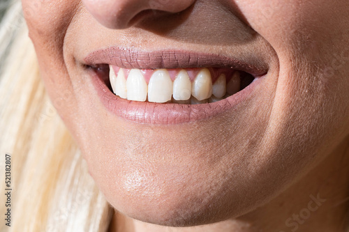 smiling mouth of girl with very white teeth