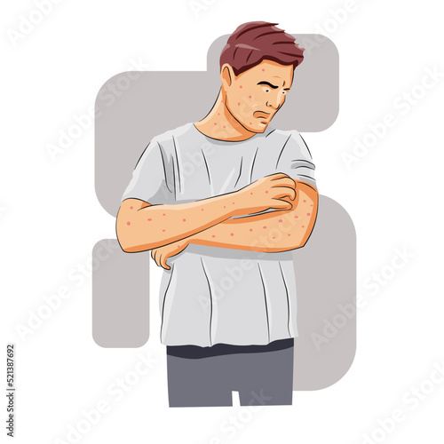 Man having chicken pox disease 