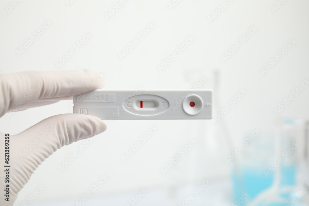 Doctor holding disposable express test for hepatitis indoors, closeup Doctor holding disposable express test for hepatitis indoors, closeup
