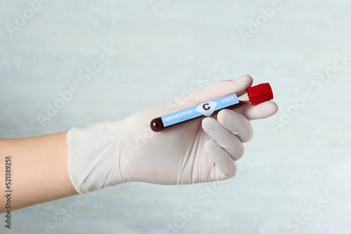 Scientist holding tube with blood sample and label Hepatitis C test on light background, closeup
