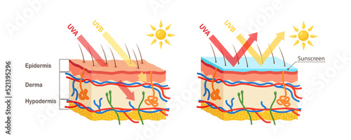 UV protection. Sunscreen lotion protect human skin from UVA, UVB ray