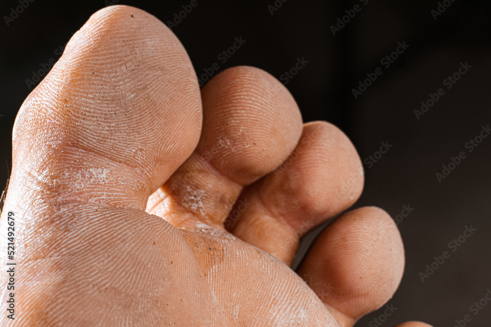 Macro close up of dirty feet with dry skin and problems with fungus, skin care concept. Macro close up of dirty feet with dry skin and problems with fungus, skin care concept.