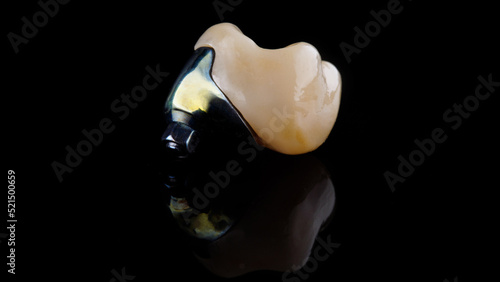 dental composition of the crown of the chewing tooth with a titanium abutment on a black background with reflection