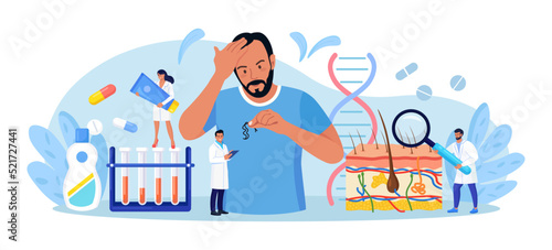 Alopecia and hair problems, baldness. Man looks sadly at strands of hair in hand. Person feel upset because of hair loss. Physician diagnosis health problem, lack of vitamins and important amino acids