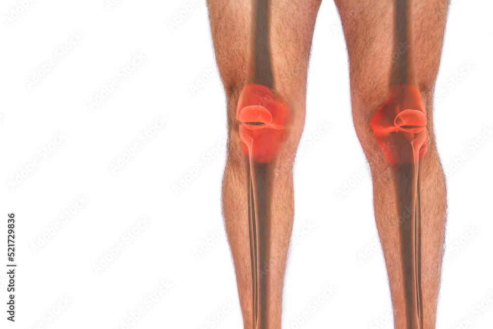 Transparent image of femur, fibula and tibia bones of a man suffering from joint pain on white isolated background Transparent image of femur, fibula and tibia bones of a man suffering from joint pain on white isolated background
